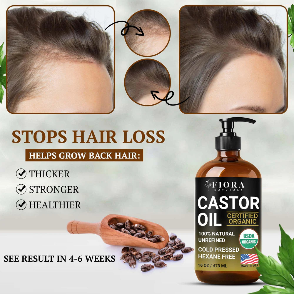ACEITE DE CASTOR OIL ORGÁNICO PREMIUM – 100% PURO, PRENSADO EN FRÍO