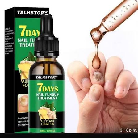 JAYSUING - 7 DAYS TRATAMIENTO PARA HONGOS EN UÑAS – PIES Y